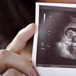 Why do women dream about pregnancy? Why do they dream about having an ultrasound scan for pregnancy?