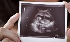 Miks naised unistavad rasedusest?Miks nad unistavad raseduse tuvastamiseks ultraheliuuringust?